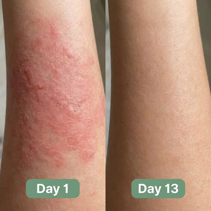 Veloma Antifungal Soap®