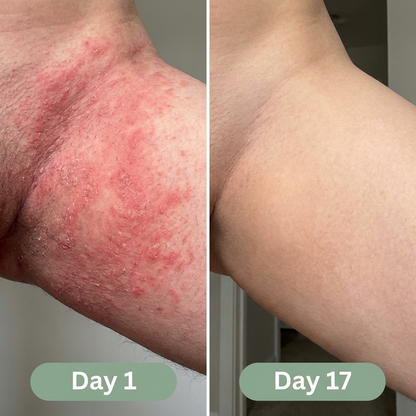 Veloma Antifungal Soap®